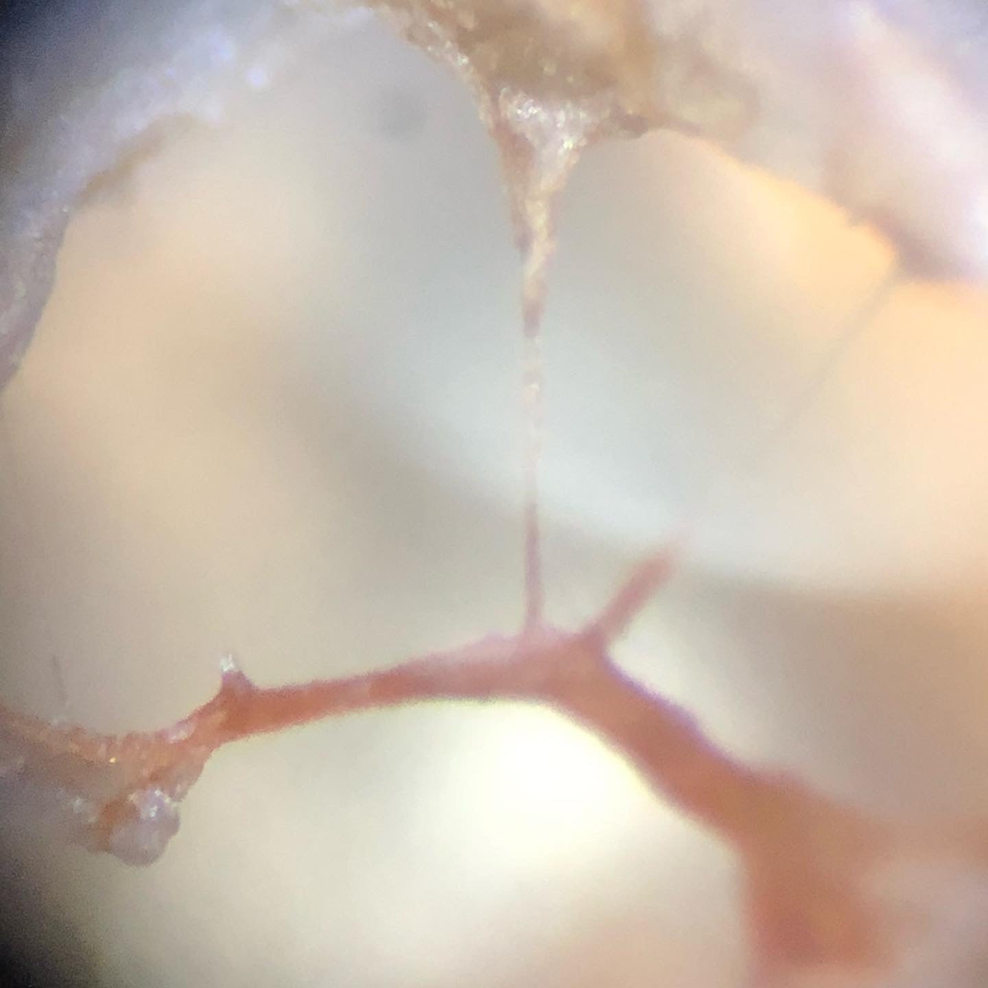 Pestalotiopsis Microspora - Pegasus Bags