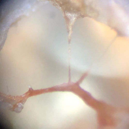 Pestalotiopsis Microspora